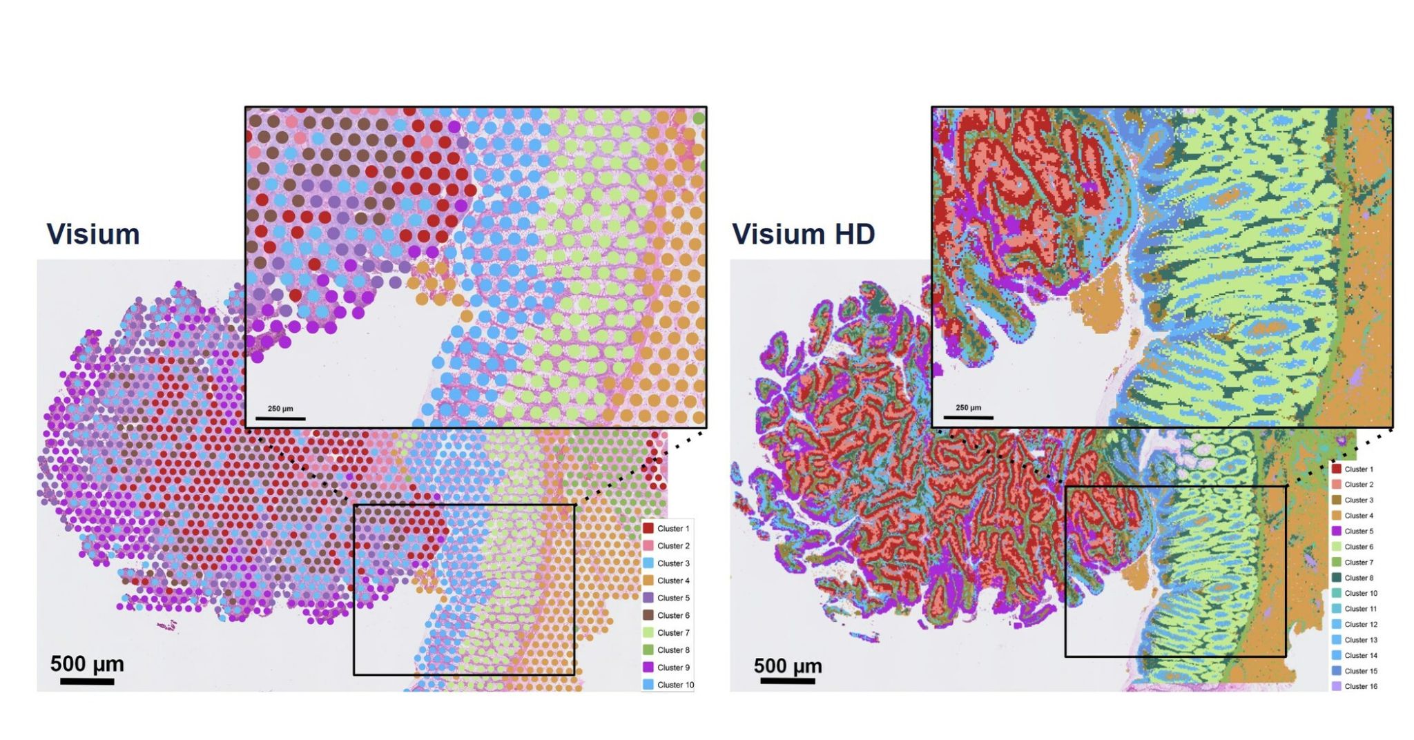 Visium과 Visium HD 비교